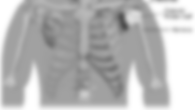 Acromioclavicular-joint-sprain