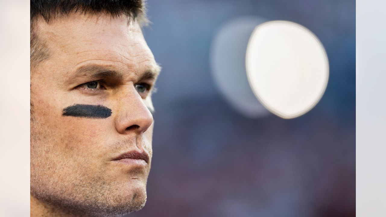 tom brady chin