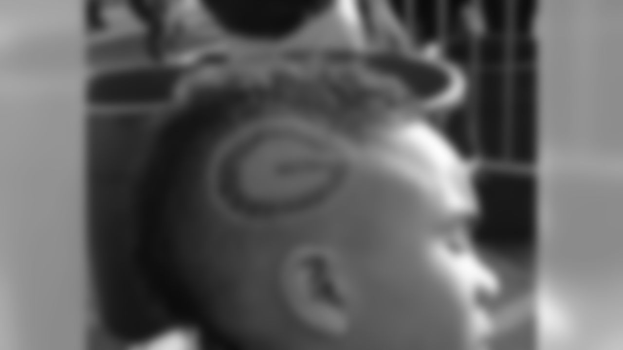 Packers vs Vikings