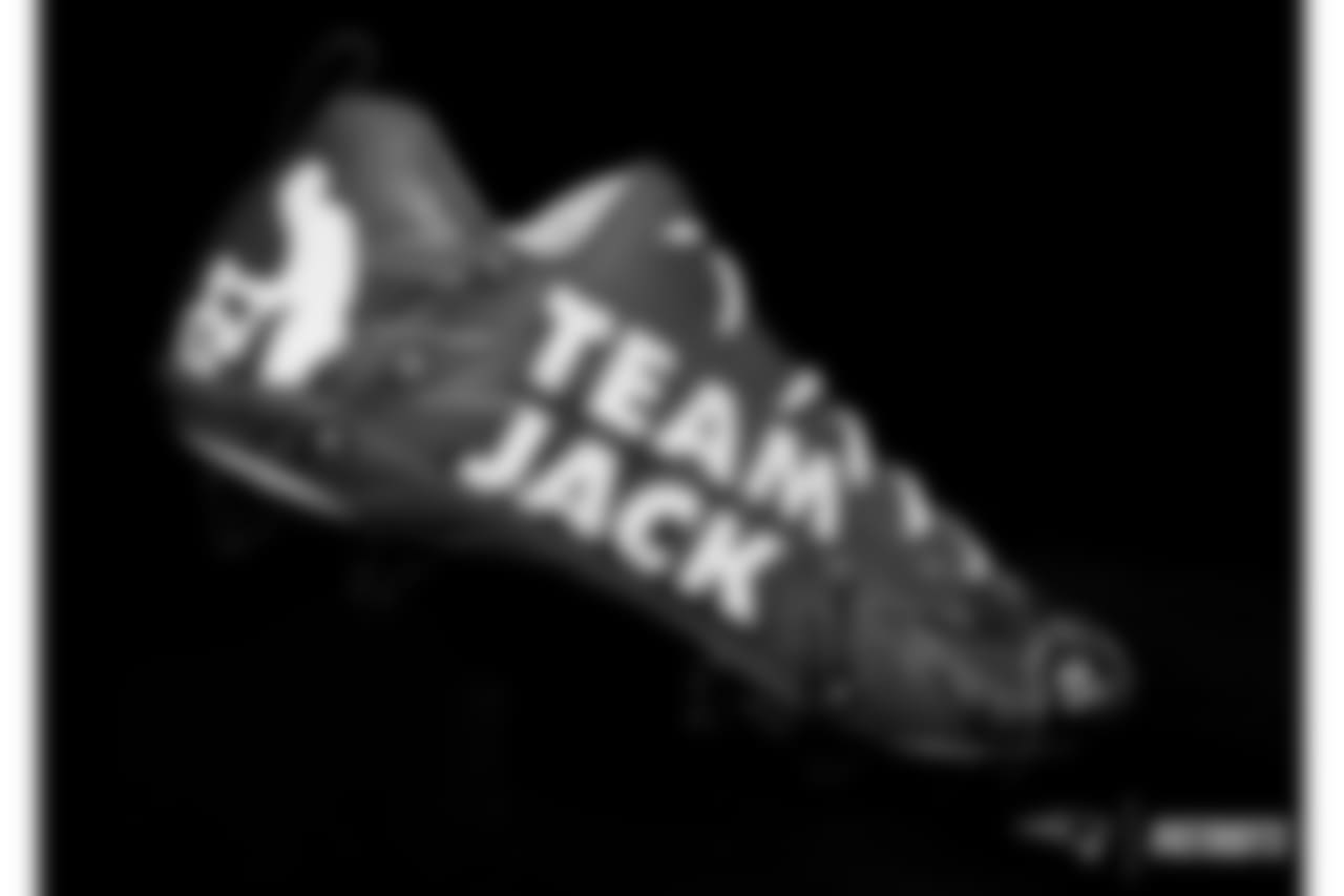 Rex Burkhead - Team Jack Foundation (pediatric brain cancer awareness).